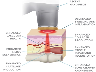 Laser Therapy Science Cutaway
